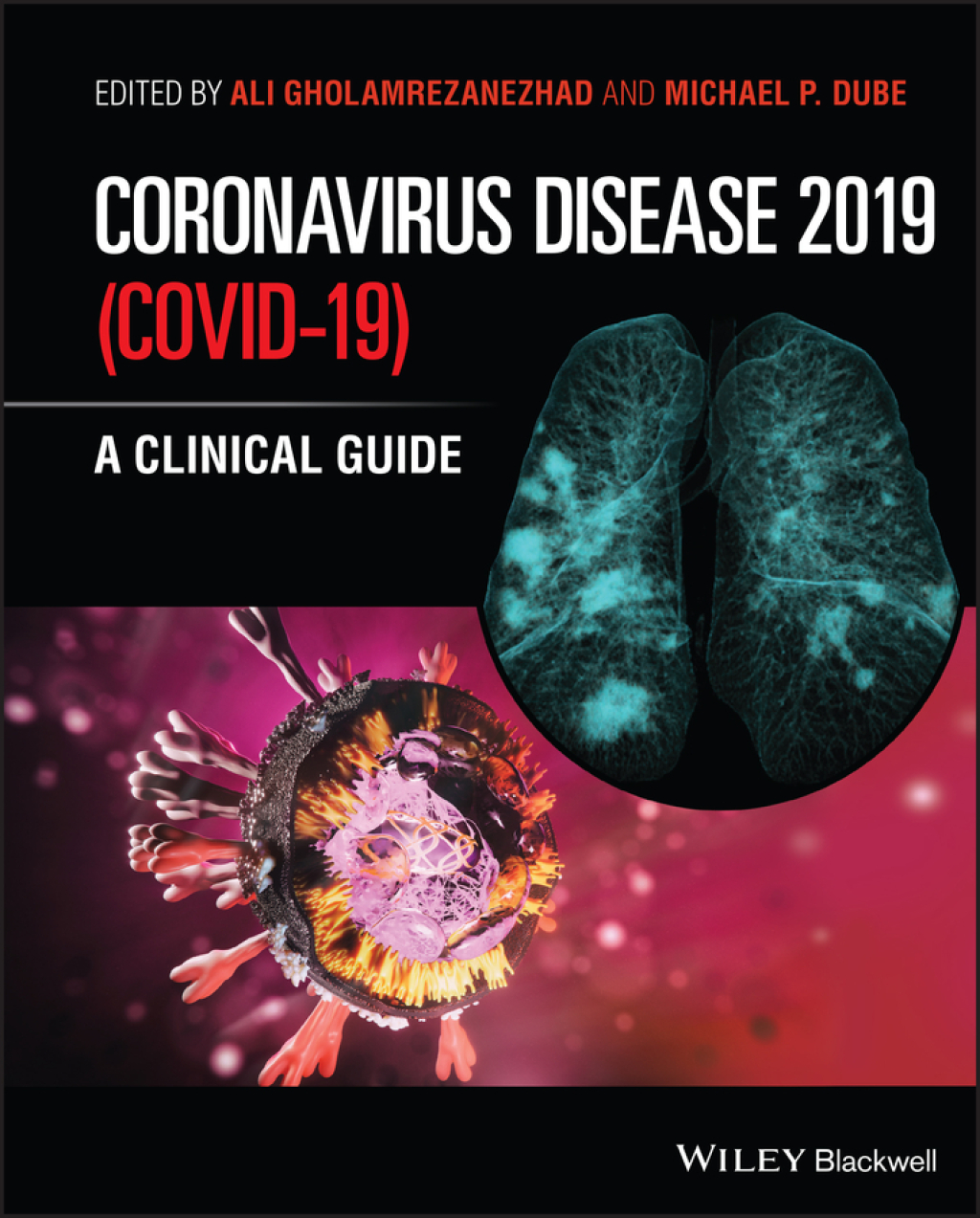 Coronavirus Disease 2019 (Covid-19) A Clinical Guide 1st Edition