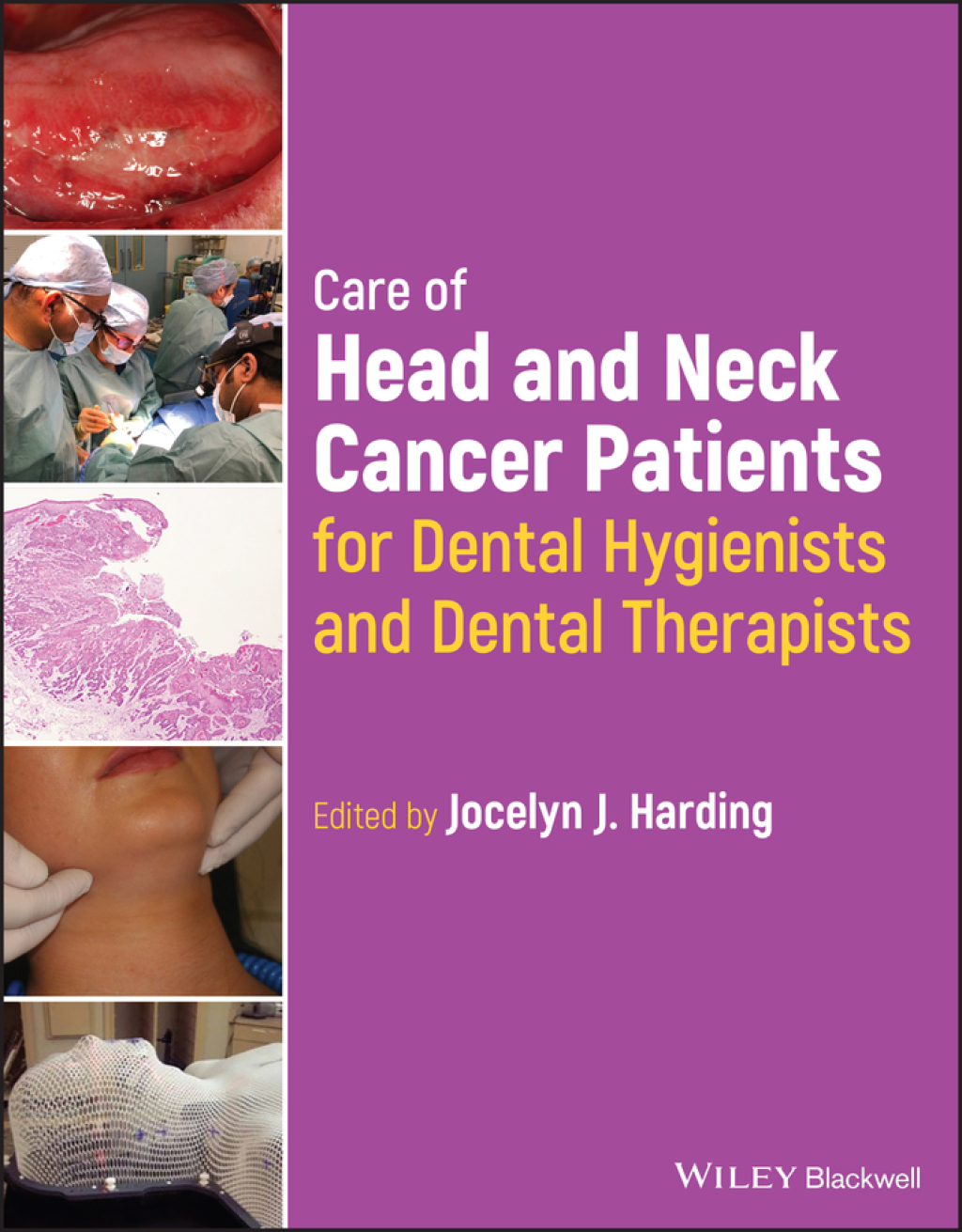 Care of Head and Neck Cancer Patients for Dental Hygienists and Dental Therapists 1st Edition