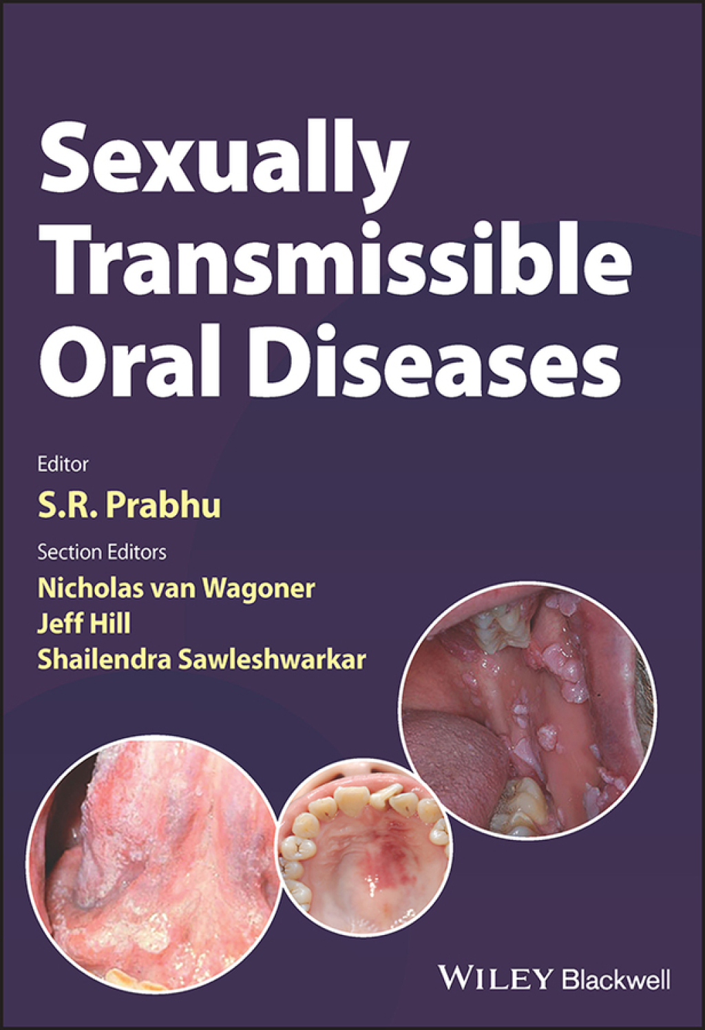 Sexually Transmissible Oral Diseases 1st Edition