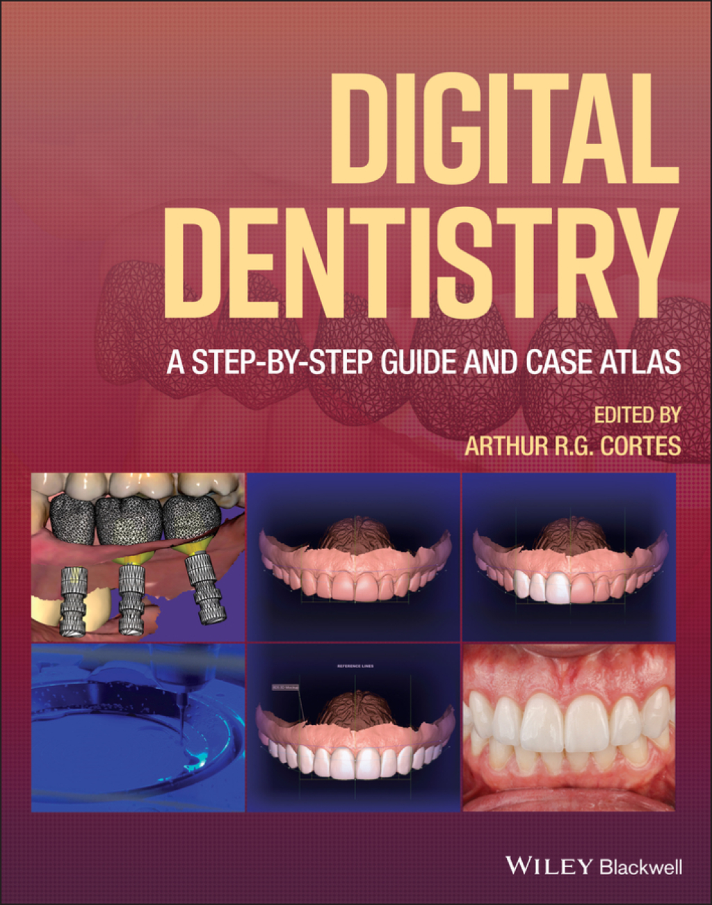 Digital Dentistry: A Step-by-Step Guide and Case Atlas A Step-by-Step Guide and Case Atlas 1st Edition