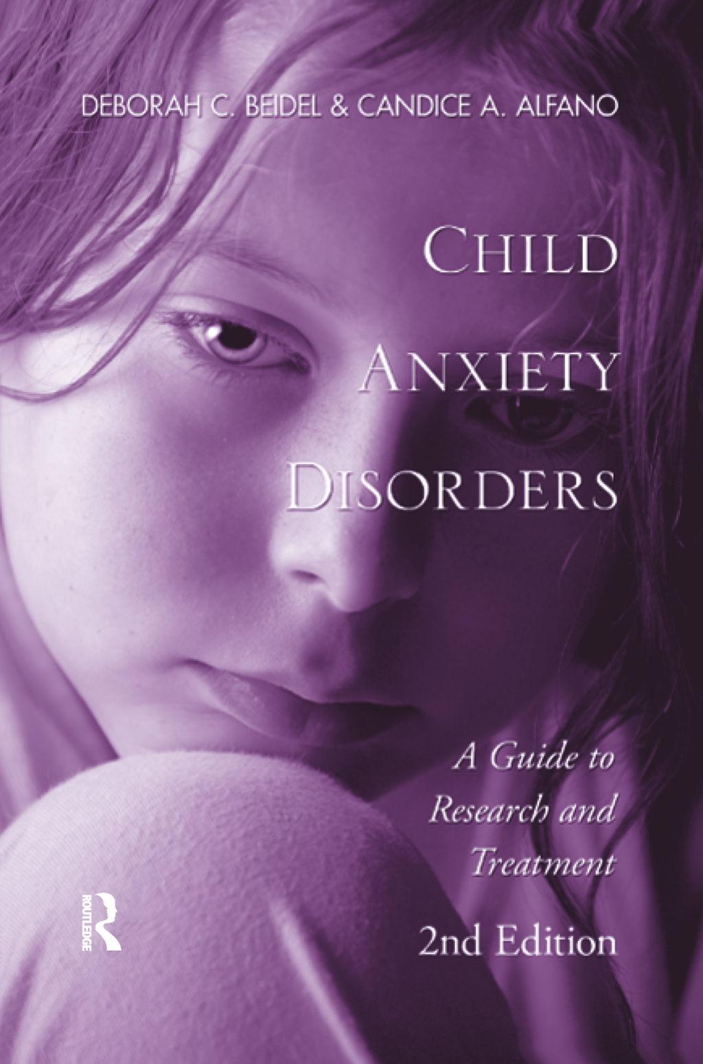 Child Anxiety Disorders A Guide to Research and Treatment, 2nd Edition 2nd Edition