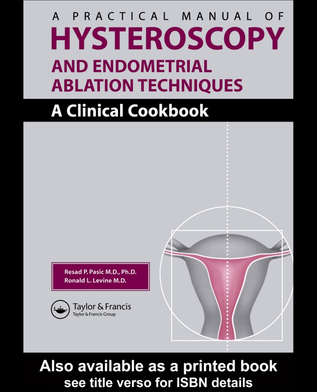 A Practical Manual of Hysteroscopy and Endometrial Ablation Techniques A Clinical Cookbook 1st Edition