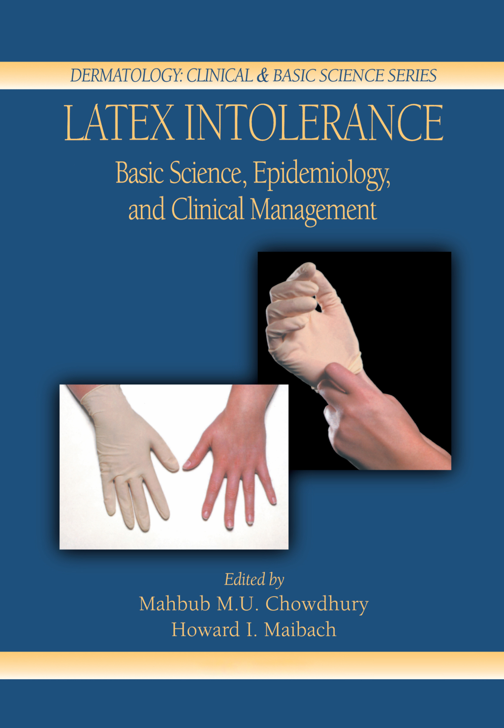 Latex Intolerance Basic Science, Epidemiology, and Clinical Management 1st Edition