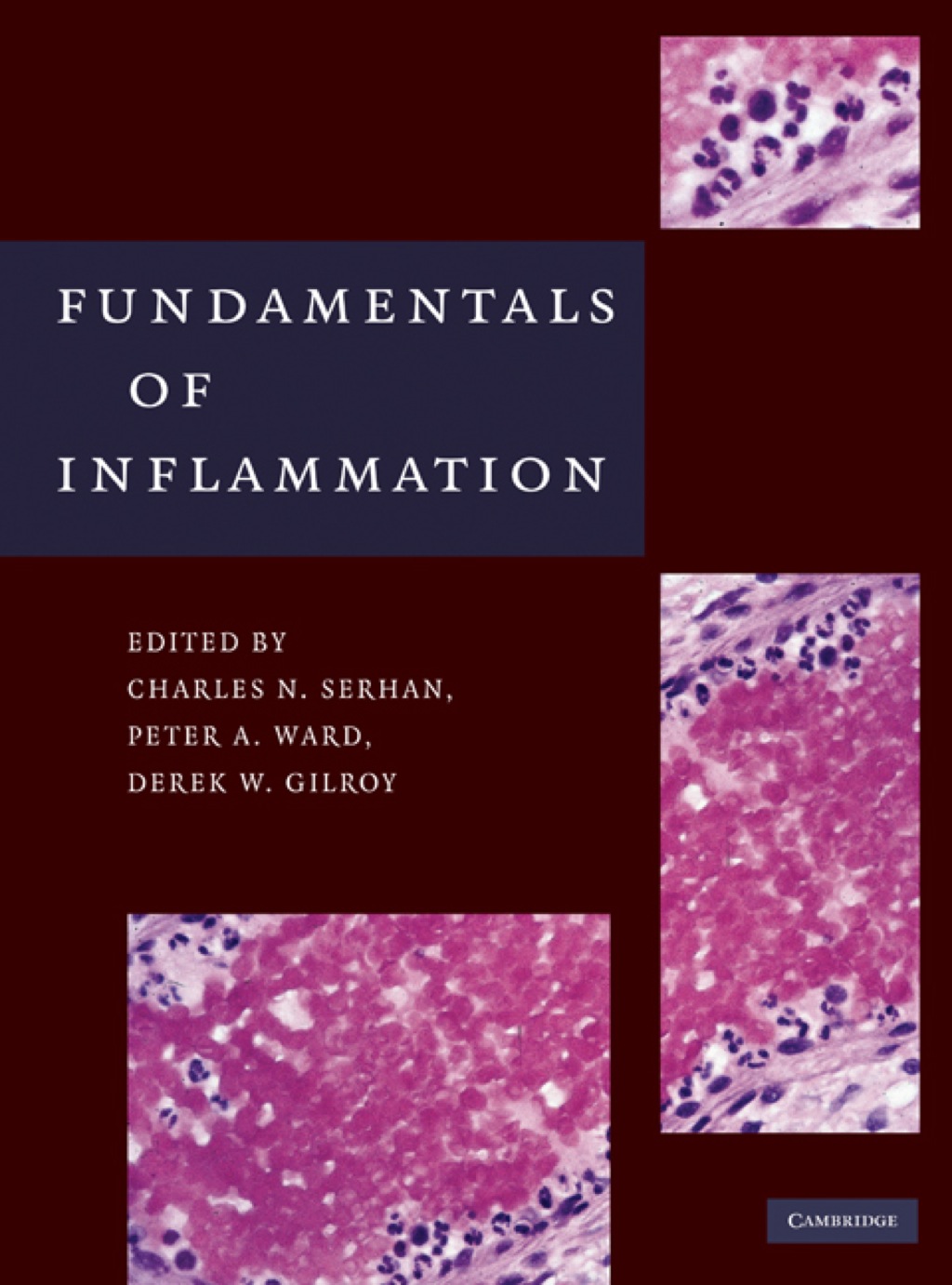 Fundamentals of Inflammation 1st Edition