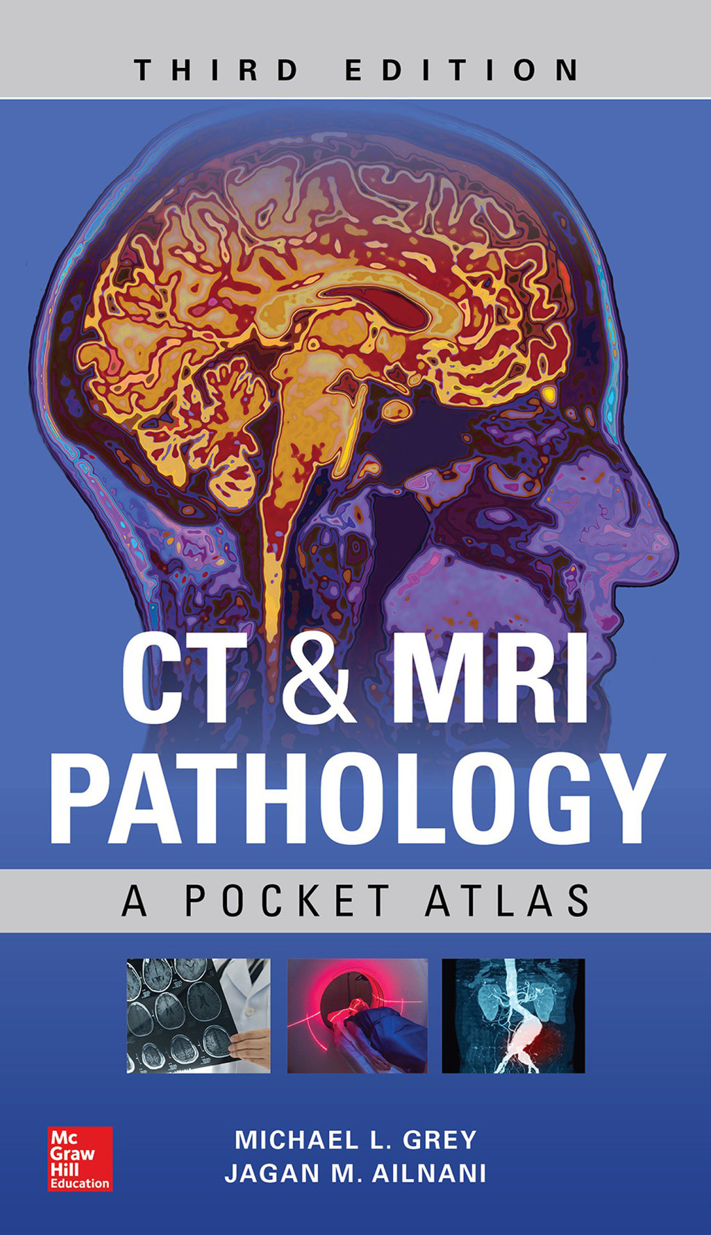 CT & MRI Pathology: A Pocket Atlas 3rd Edition