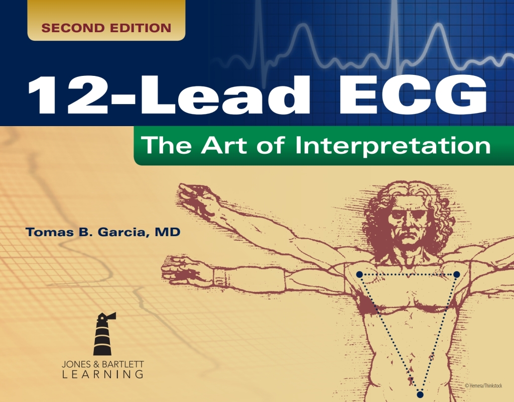 12-Lead ECG: The Art of Interpretation The Art of Interpretation 2nd Edition