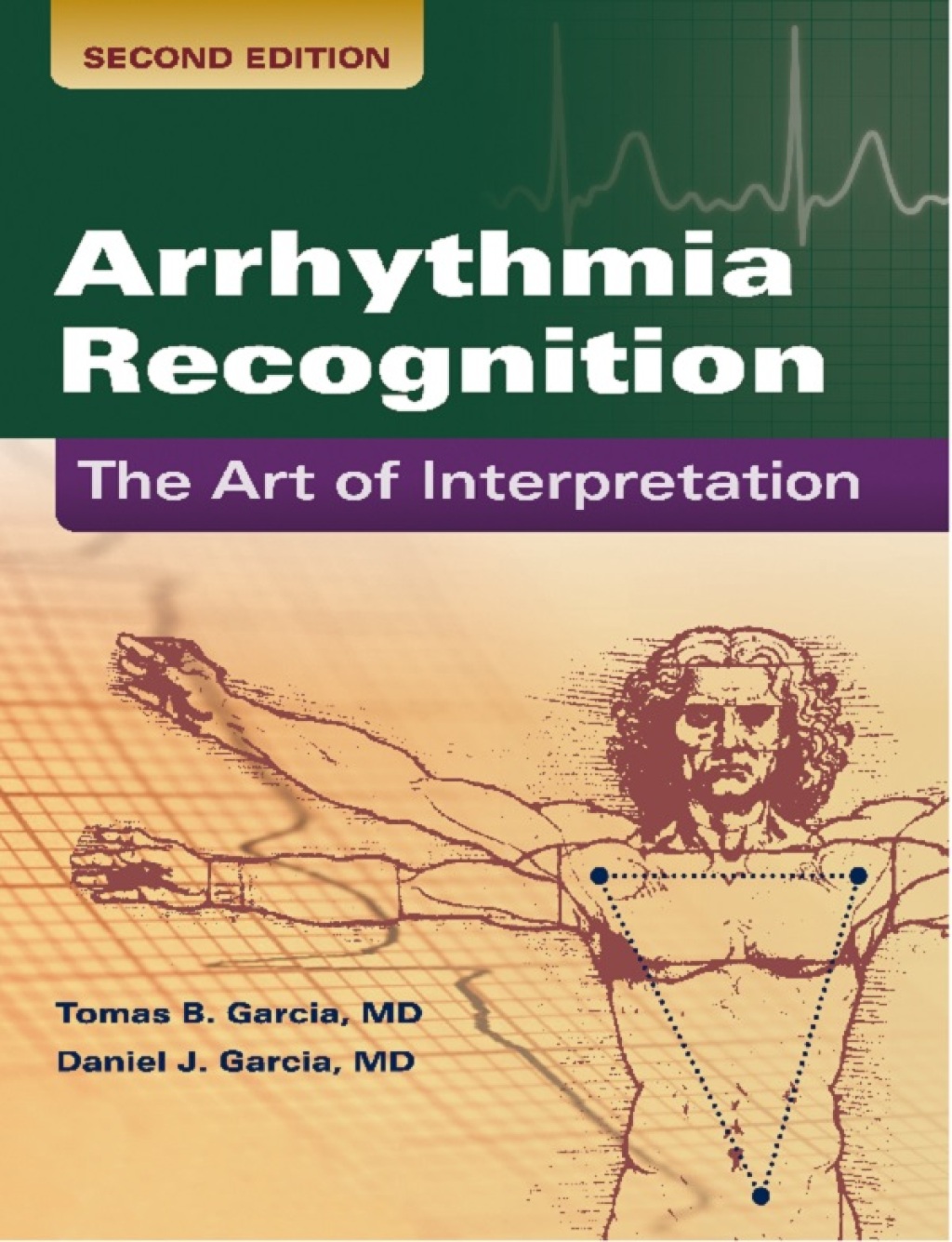 Arrhythmia Recognition: The Art of Interpretation The Art of Interpretation 2nd Edition