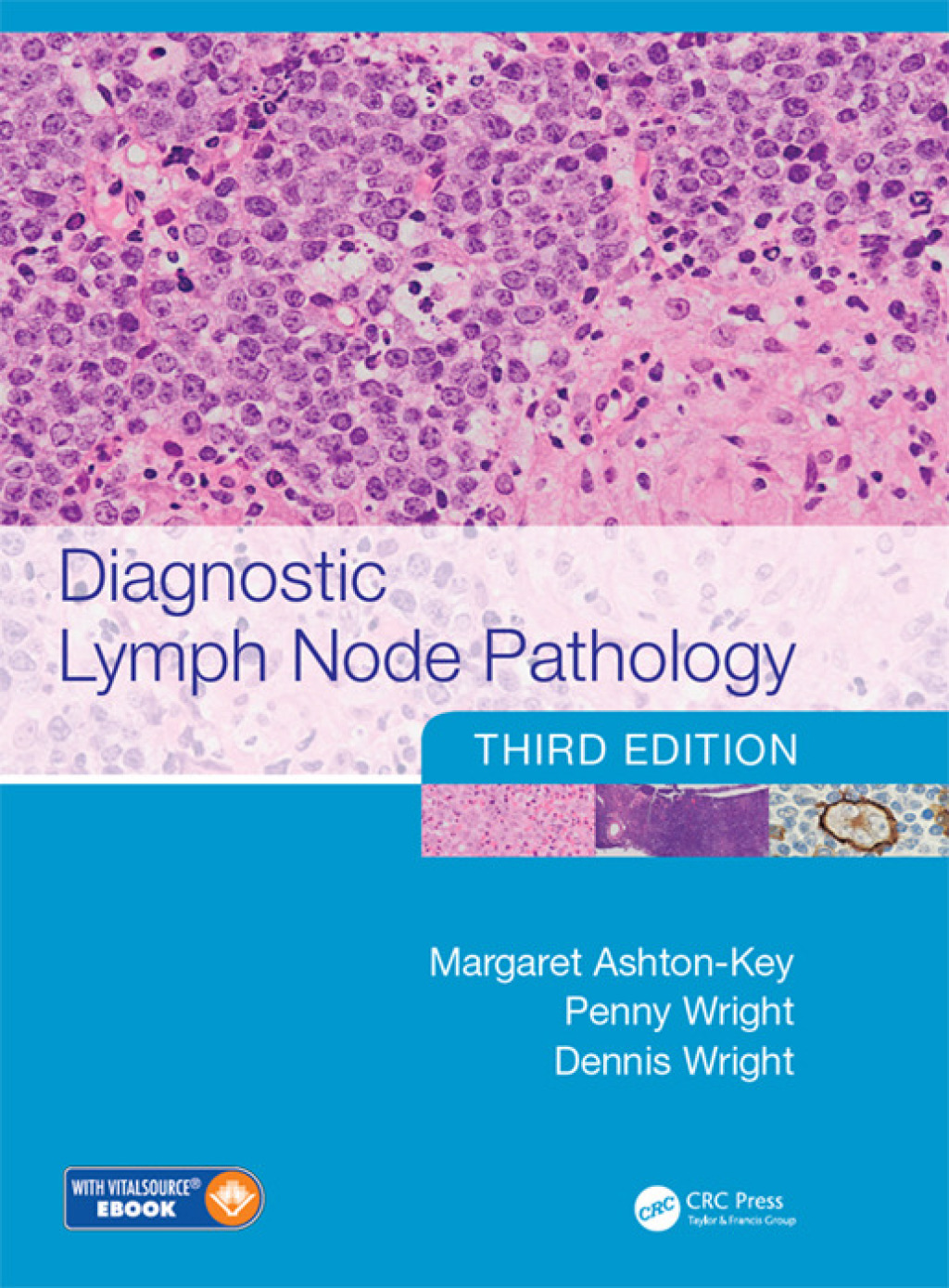 Diagnostic Lymph Node Pathology 3rd Edition