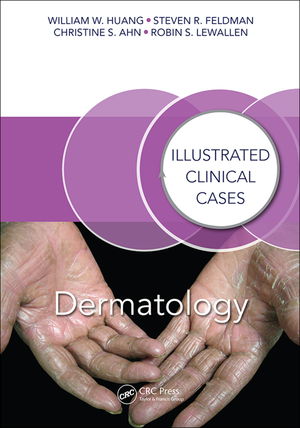Dermatology Illustrated Clinical Cases 1st Edition