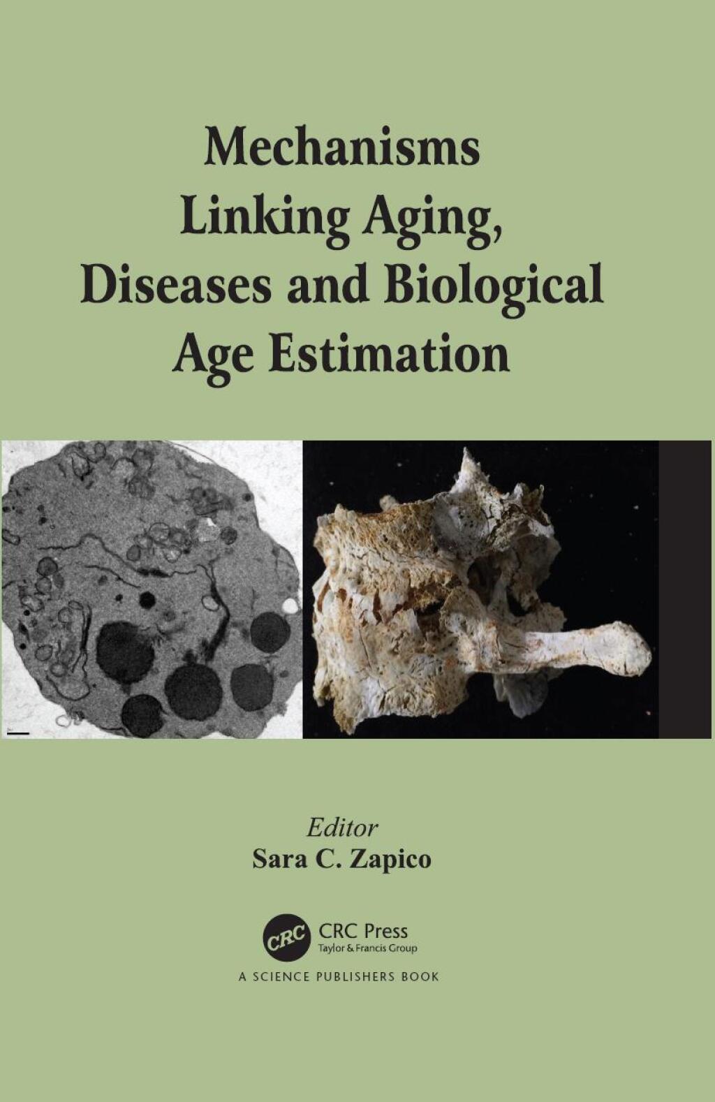 Mechanisms Linking Aging, Diseases and Biological Age Estimation 1st Edition