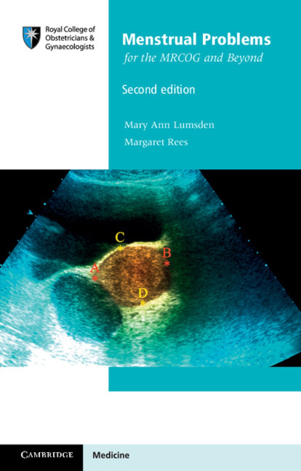 Menstrual Problems for the MRCOG and Beyond 2nd Edition