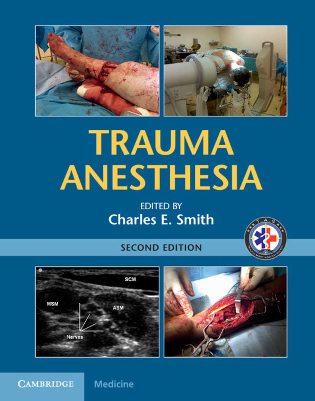 Trauma Anesthesia 2nd Edition
