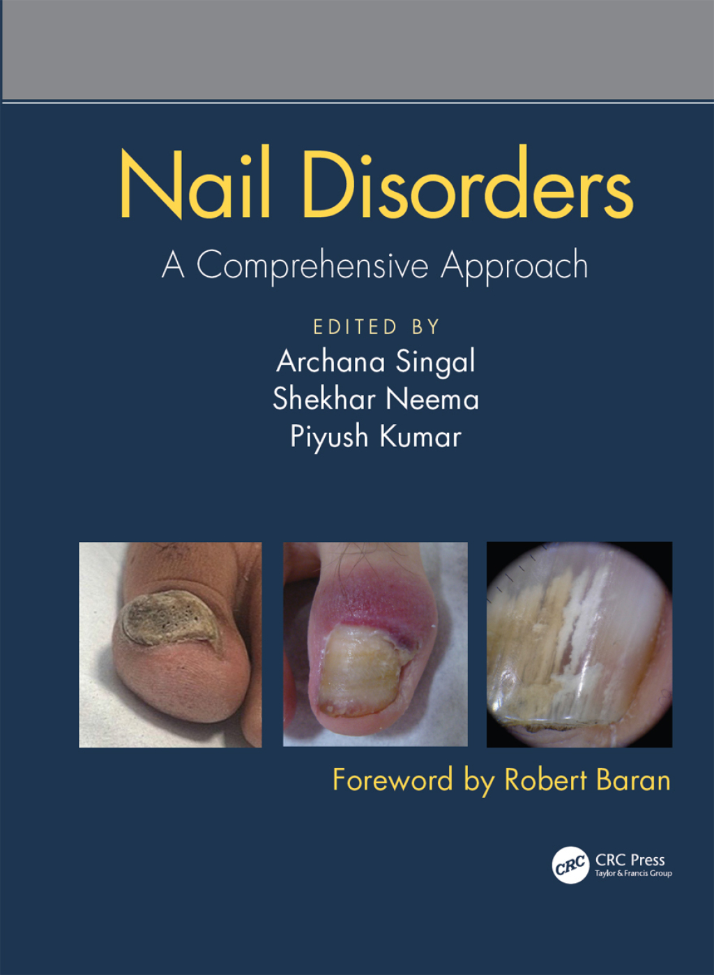 Nail Disorders A Comprehensive Approach 1st Edition