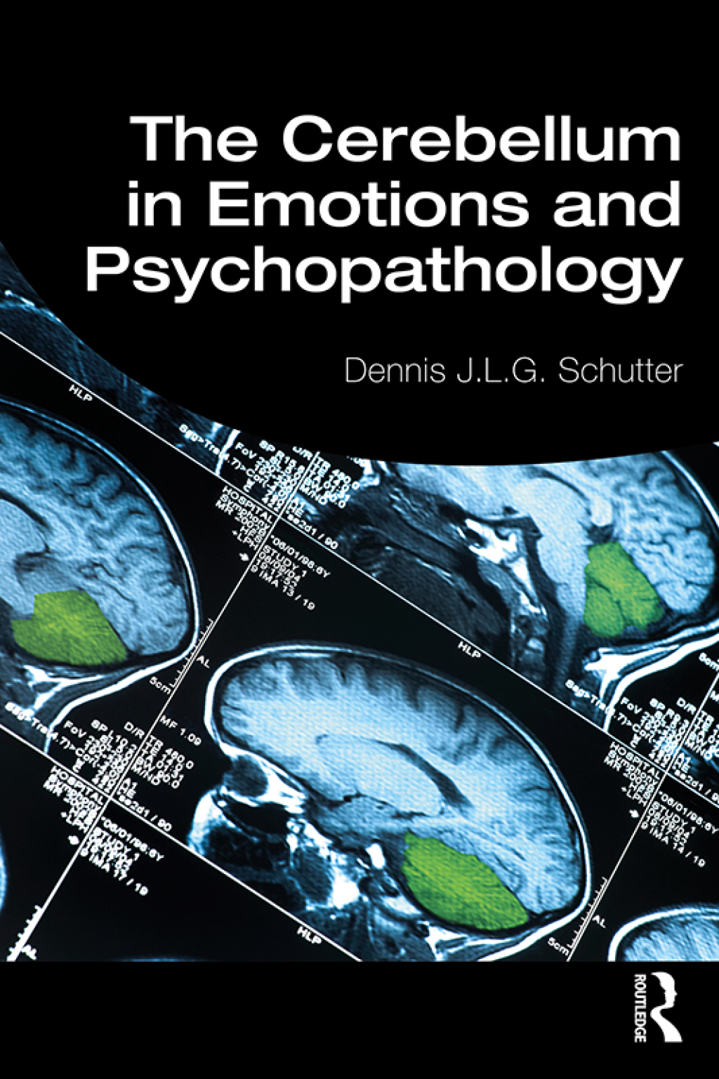 The Cerebellum in Emotions and Psychopathology 1st Edition