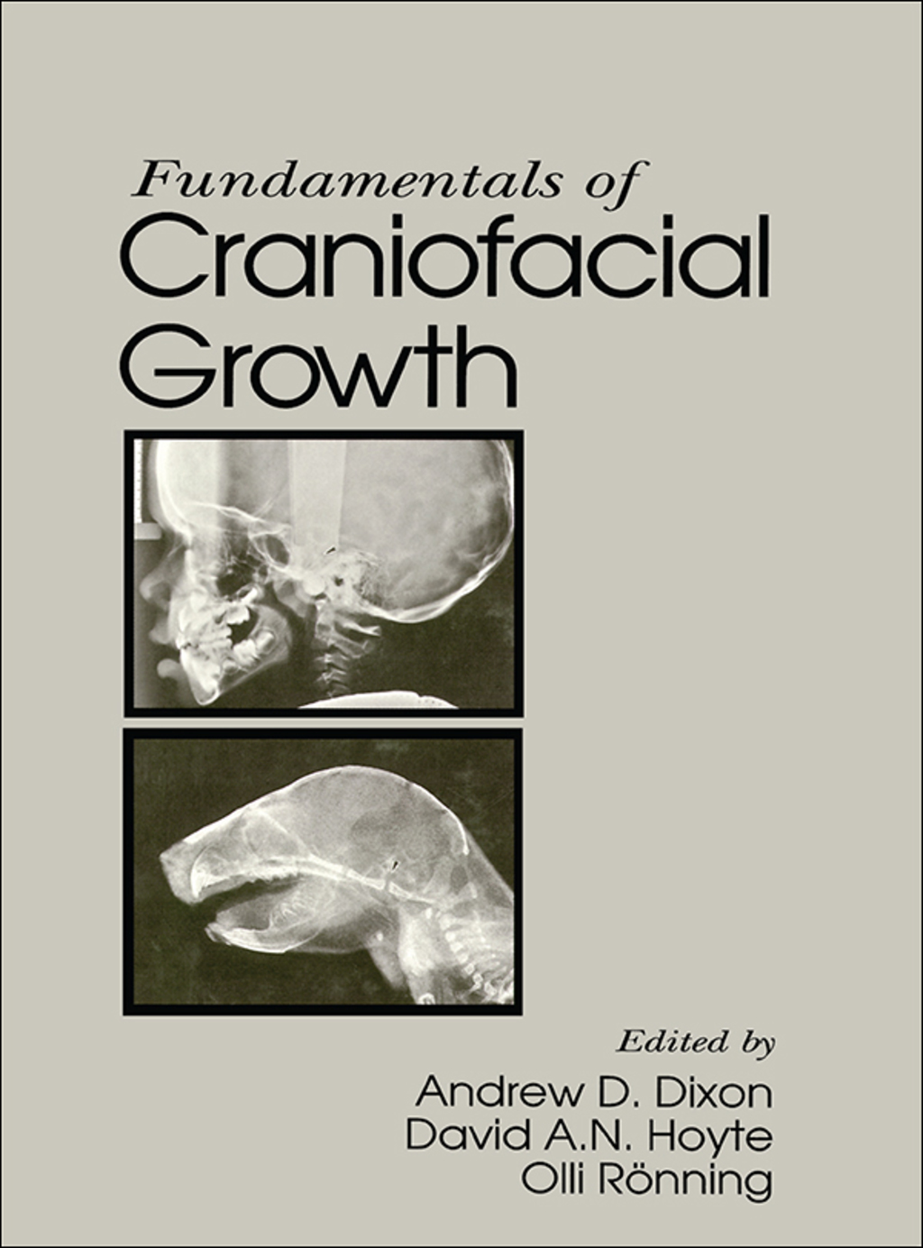Fundamentals of Craniofacial Growth 1st Edition