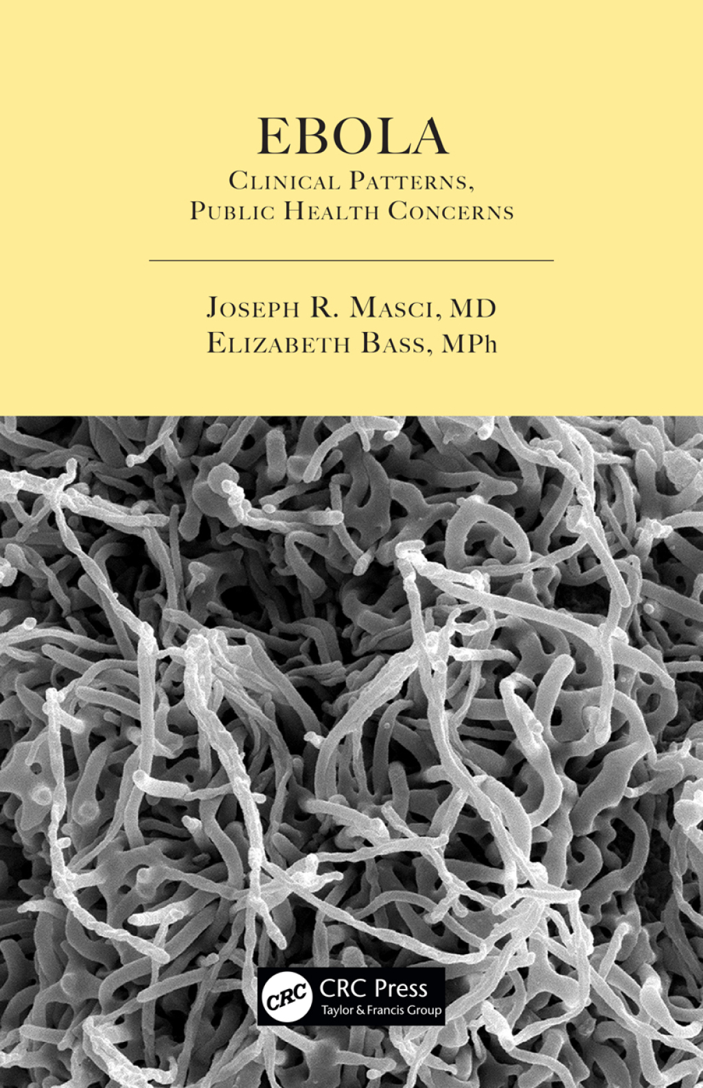 Ebola Clinical Patterns, Public Health Concerns 1st Edition