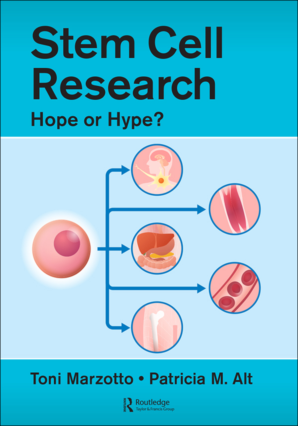 Stem Cell Research Hope or Hype? 1st Edition