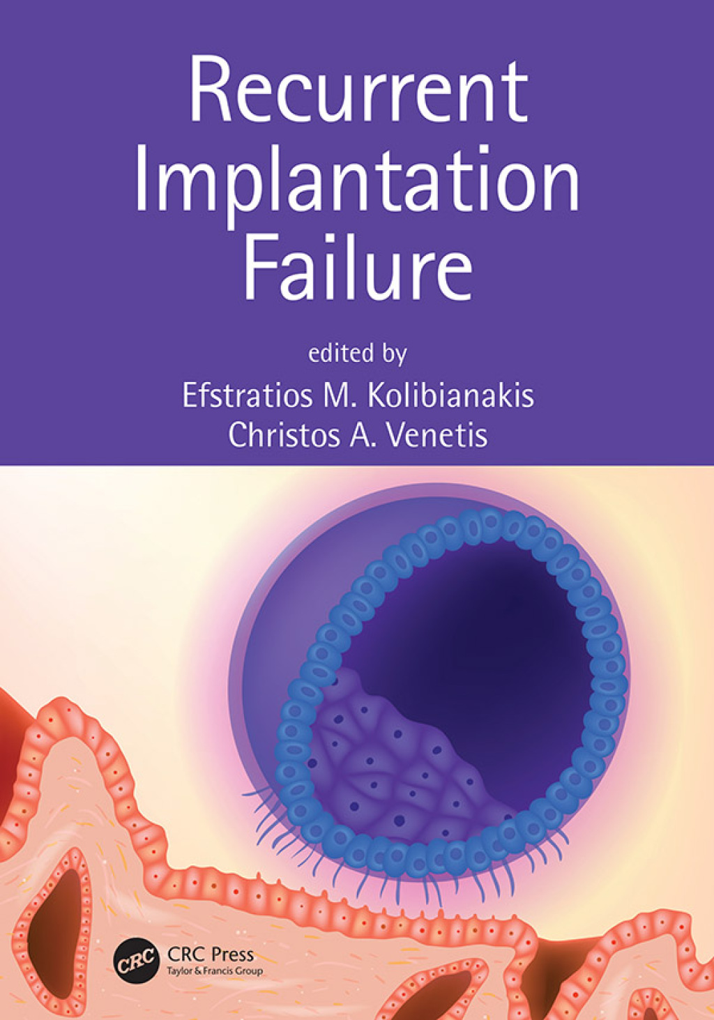 Recurrent Implantation Failure 1st Edition