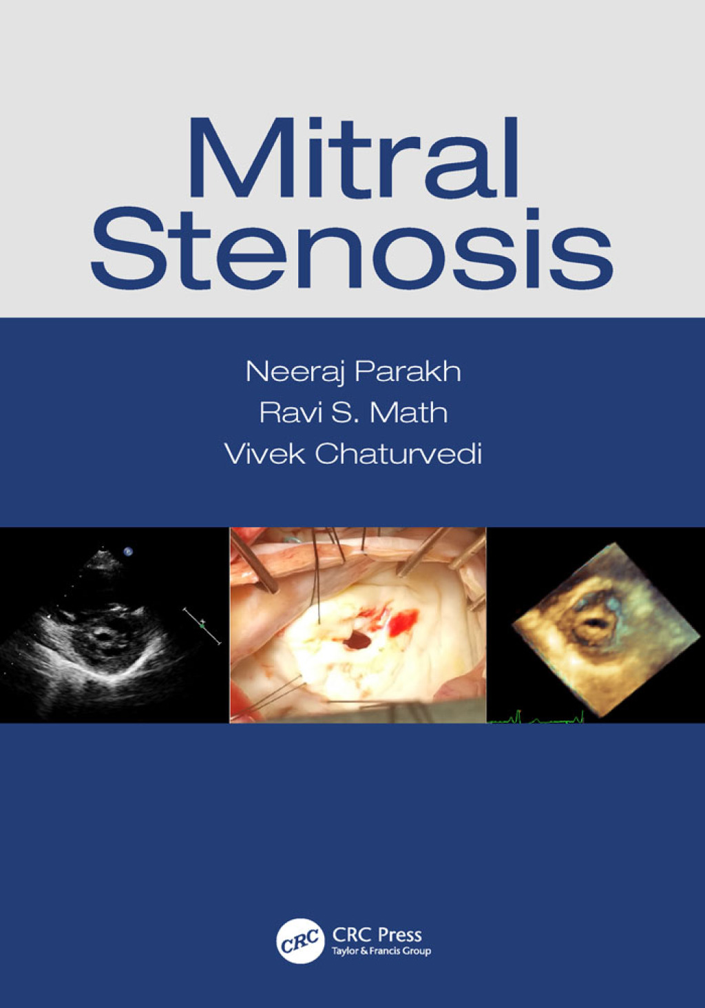 Mitral Stenosis 1st Edition