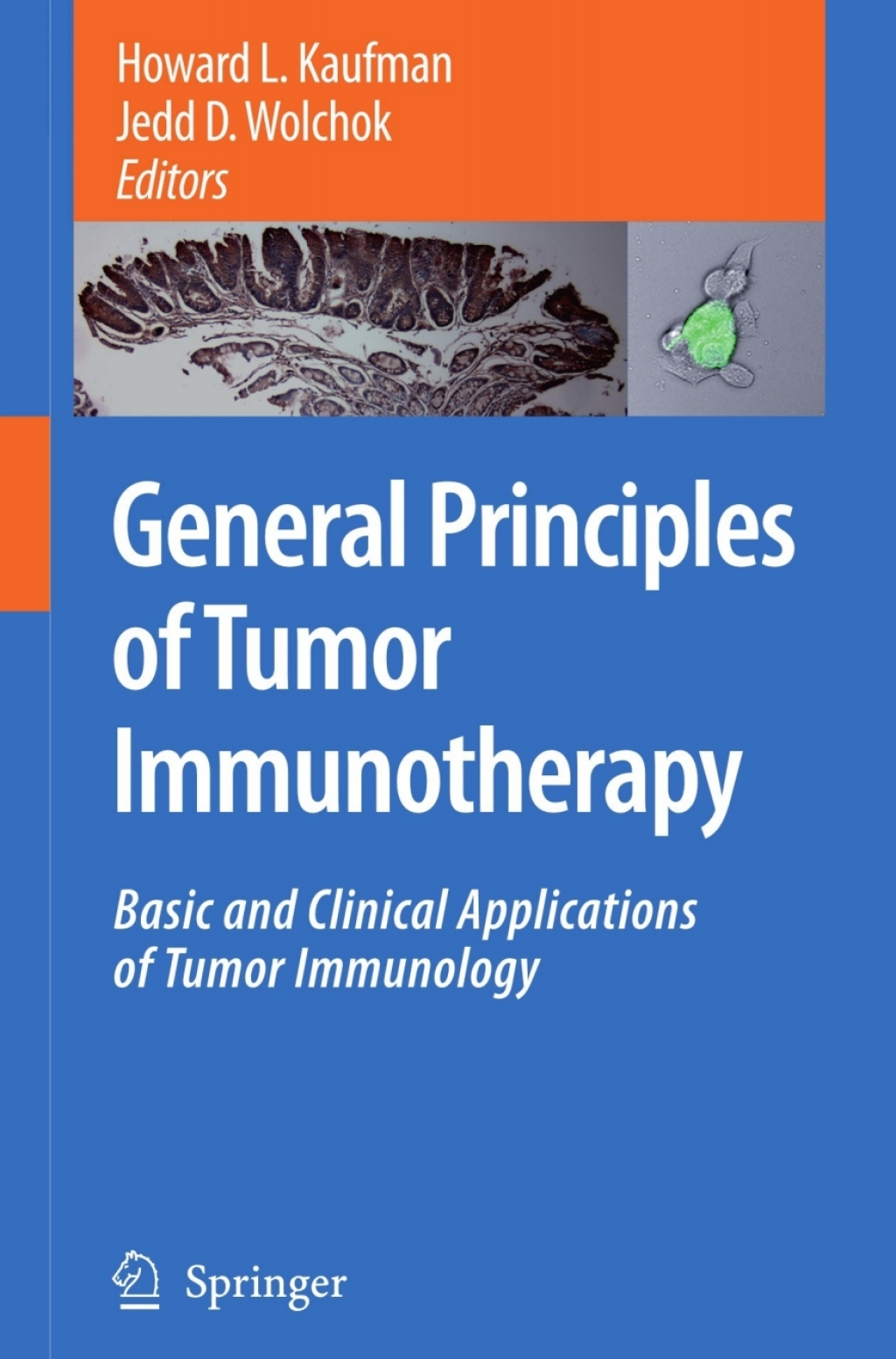 General Principles of Tumor Immunotherapy Basic and Clinical Applications of Tumor Immunology 1st Edition