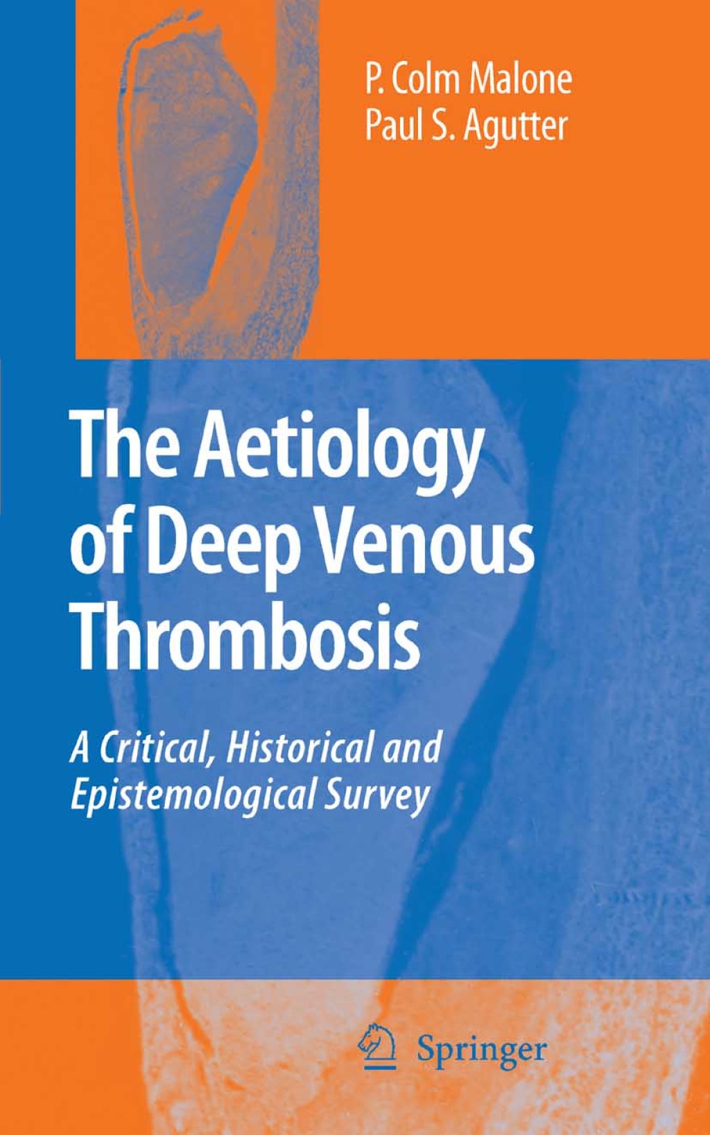 The Aetiology of Deep Venous Thrombosis A Critical, Historical and Epistemological Survey 