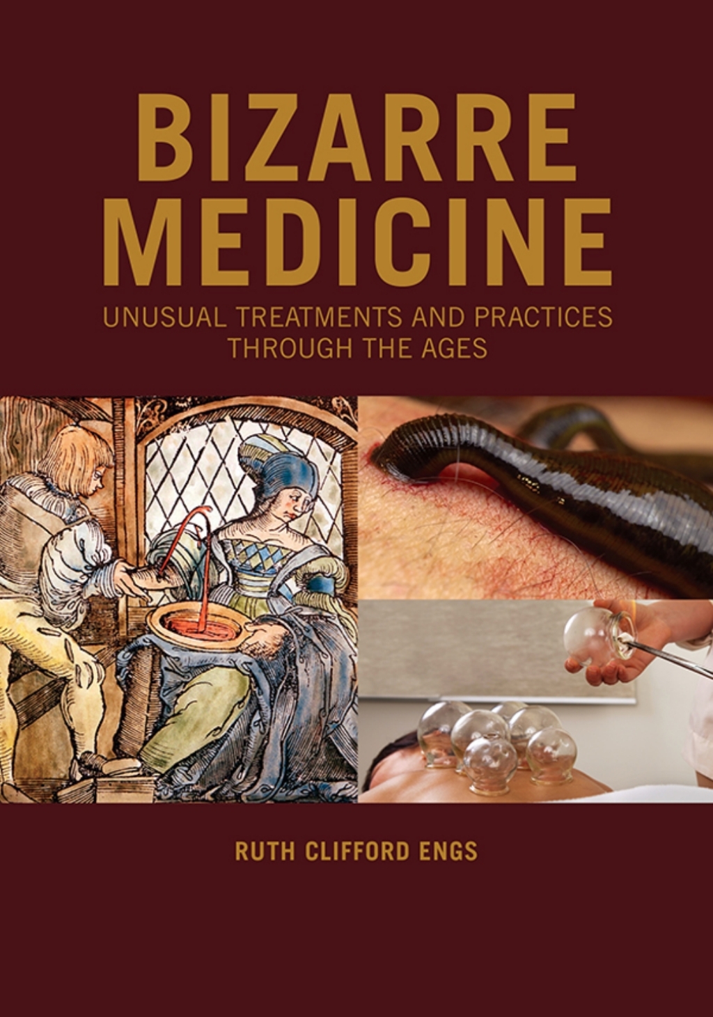 Bizarre Medicine Unusual Treatments and Practices through the Ages 1st Edition