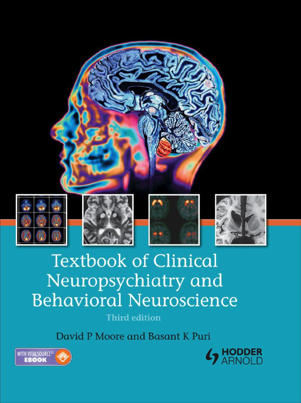 Textbook of Clinical Neuropsychiatry and Behavioral Neuroscience 3rd Edition