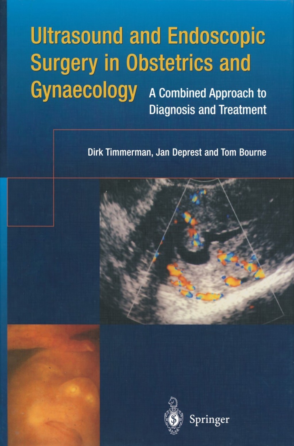 Ultrasound and Endoscopic Surgery in Obstetrics and Gynaecology A Combined Approach to Diagnosis and Treatment 