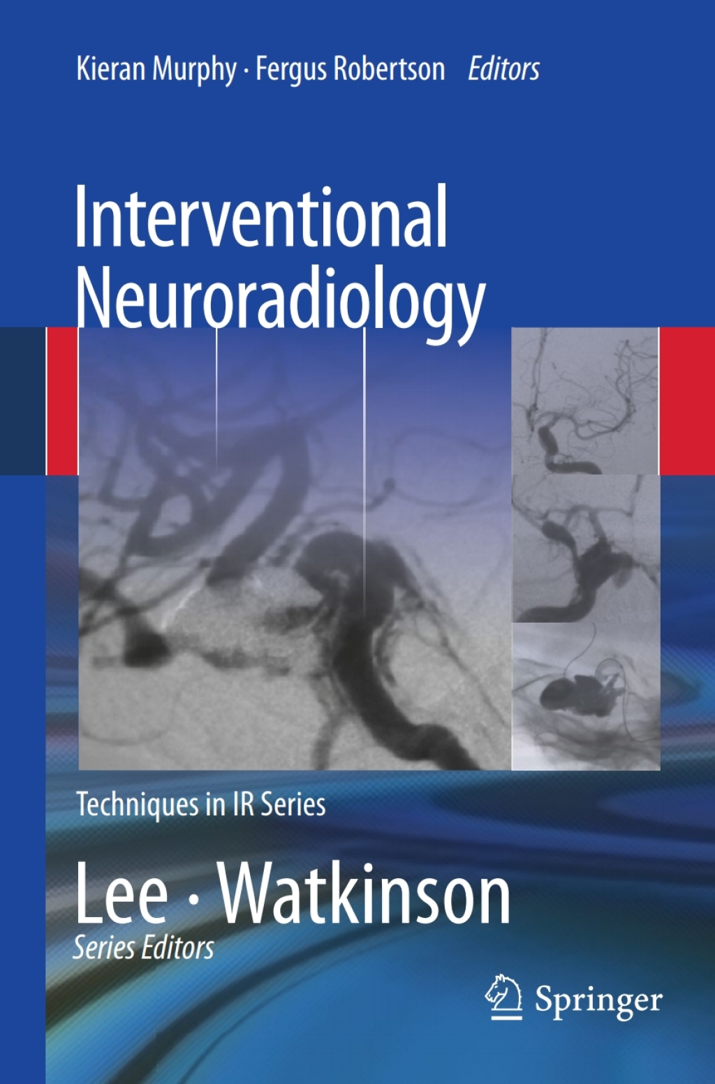 Interventional Neuroradiology 