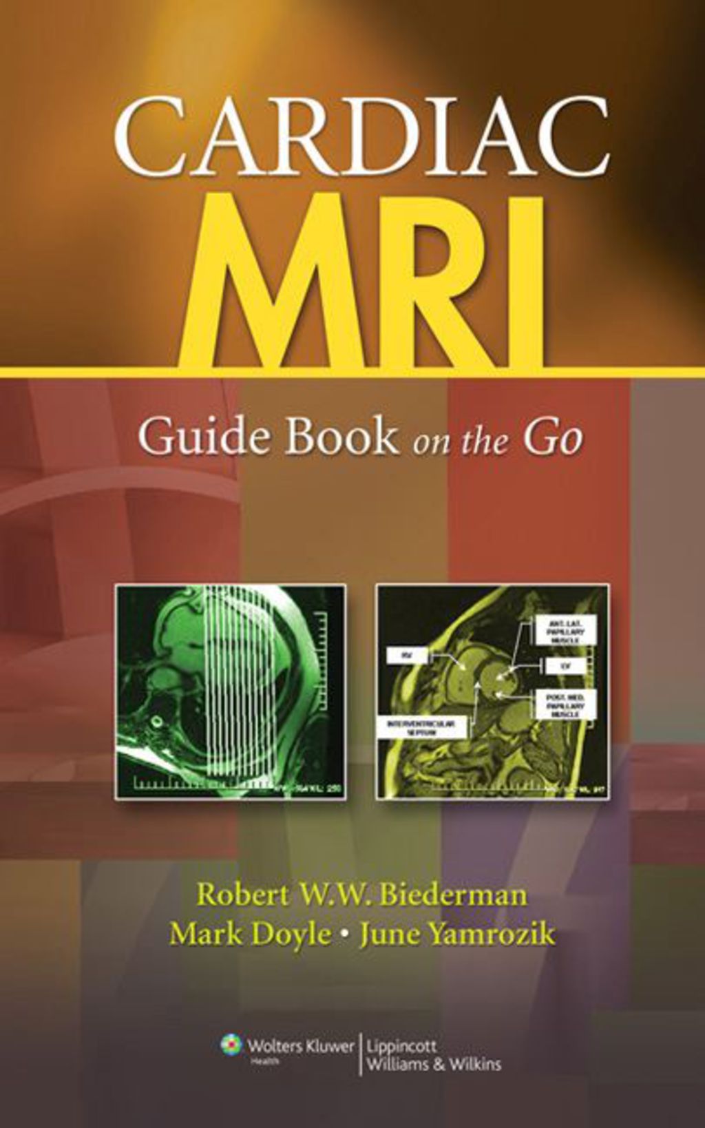 Cardiac MRI: Guide Book on the Go 1st Edition