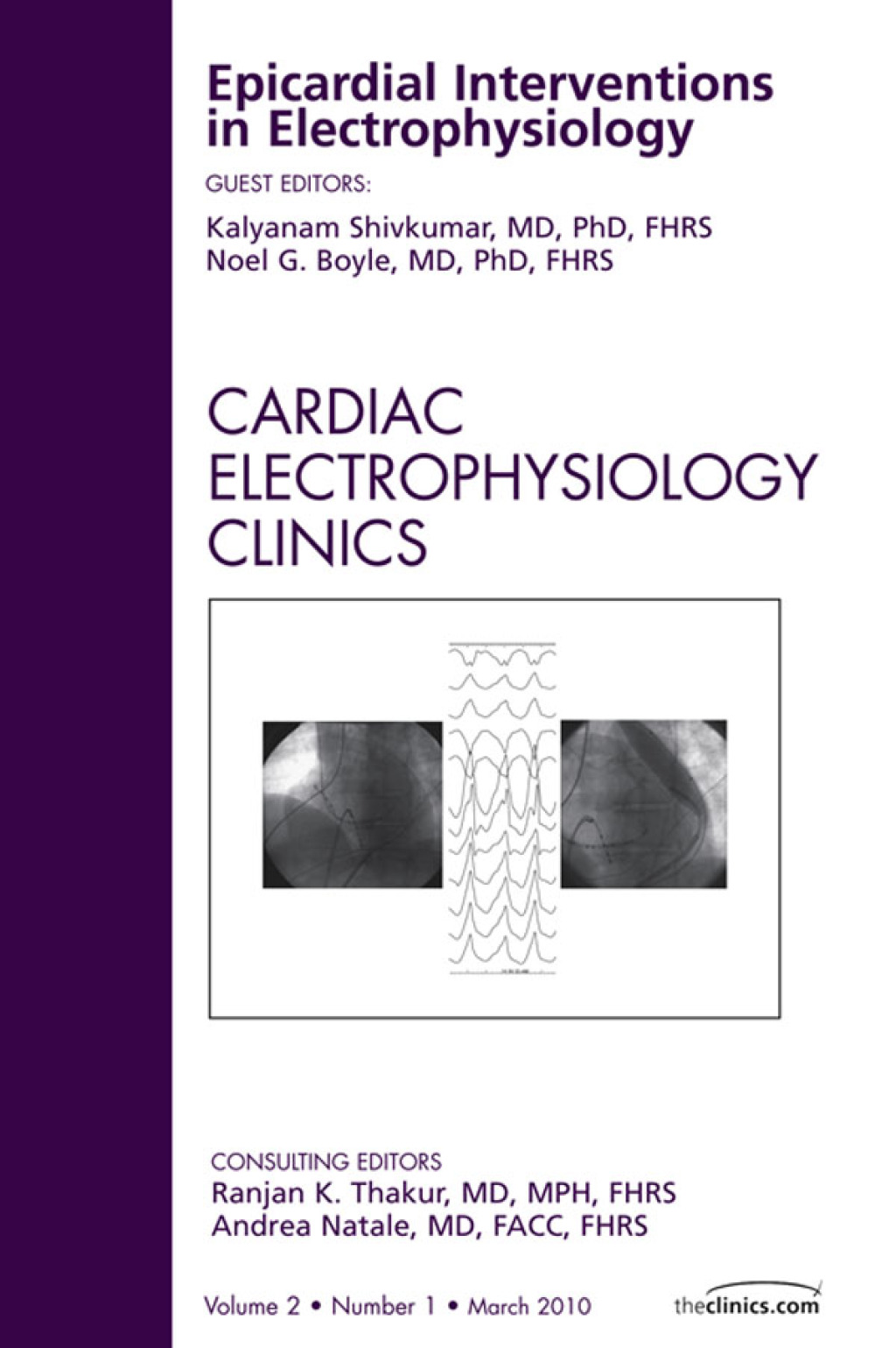 Epicardial Interventions in Electrophysiology, An Issue of Cardiac Electrophysiology Clinics 