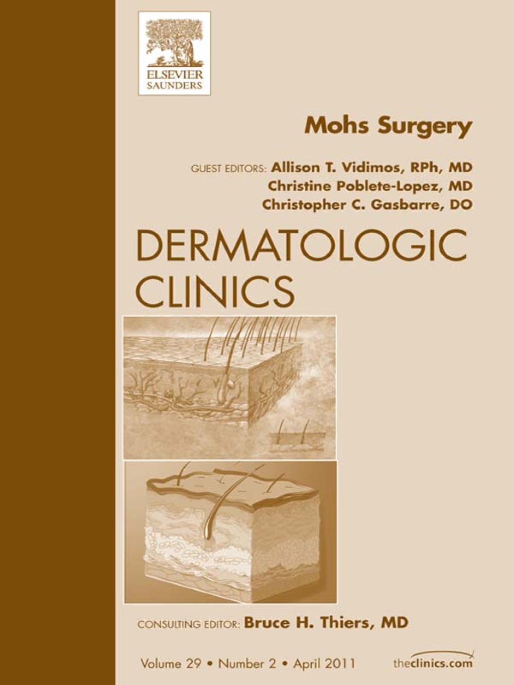 Mohs Surgery, An Issue of Dermatologic Clinics 