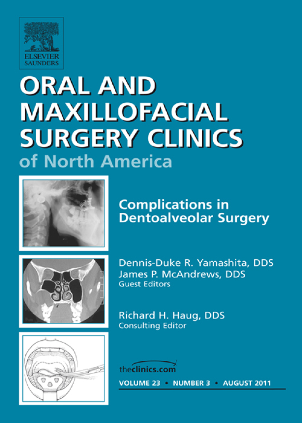 Dento-Alveolar Complications, An Issue of Oral and Maxillofacial Surgery Clinics 