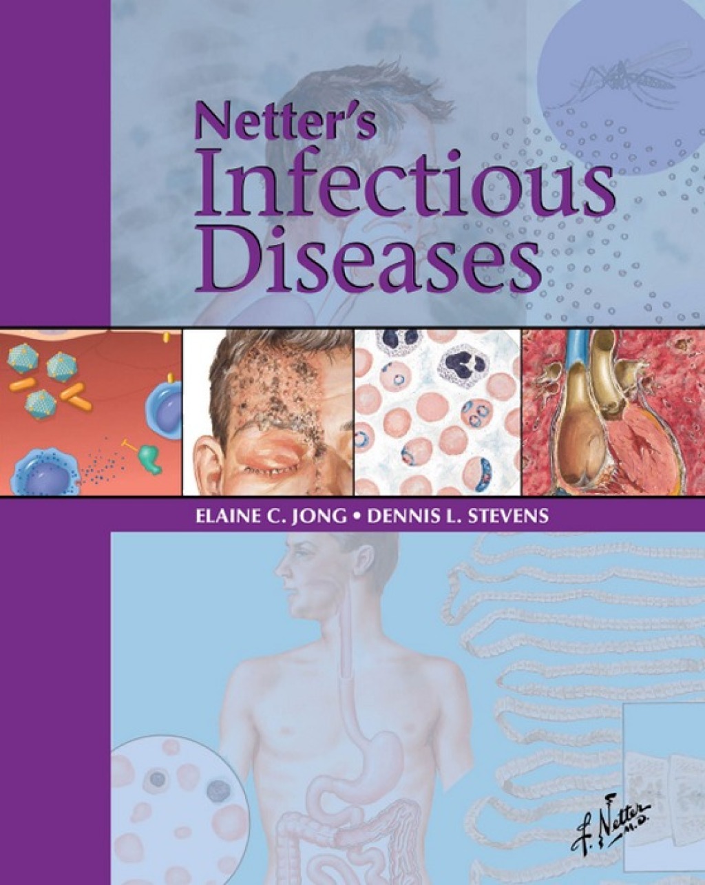 Netter's Infectious Diseases Print + Web Version 