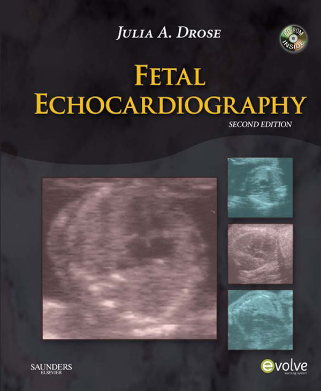 Fetal Echocardiography 2nd Edition