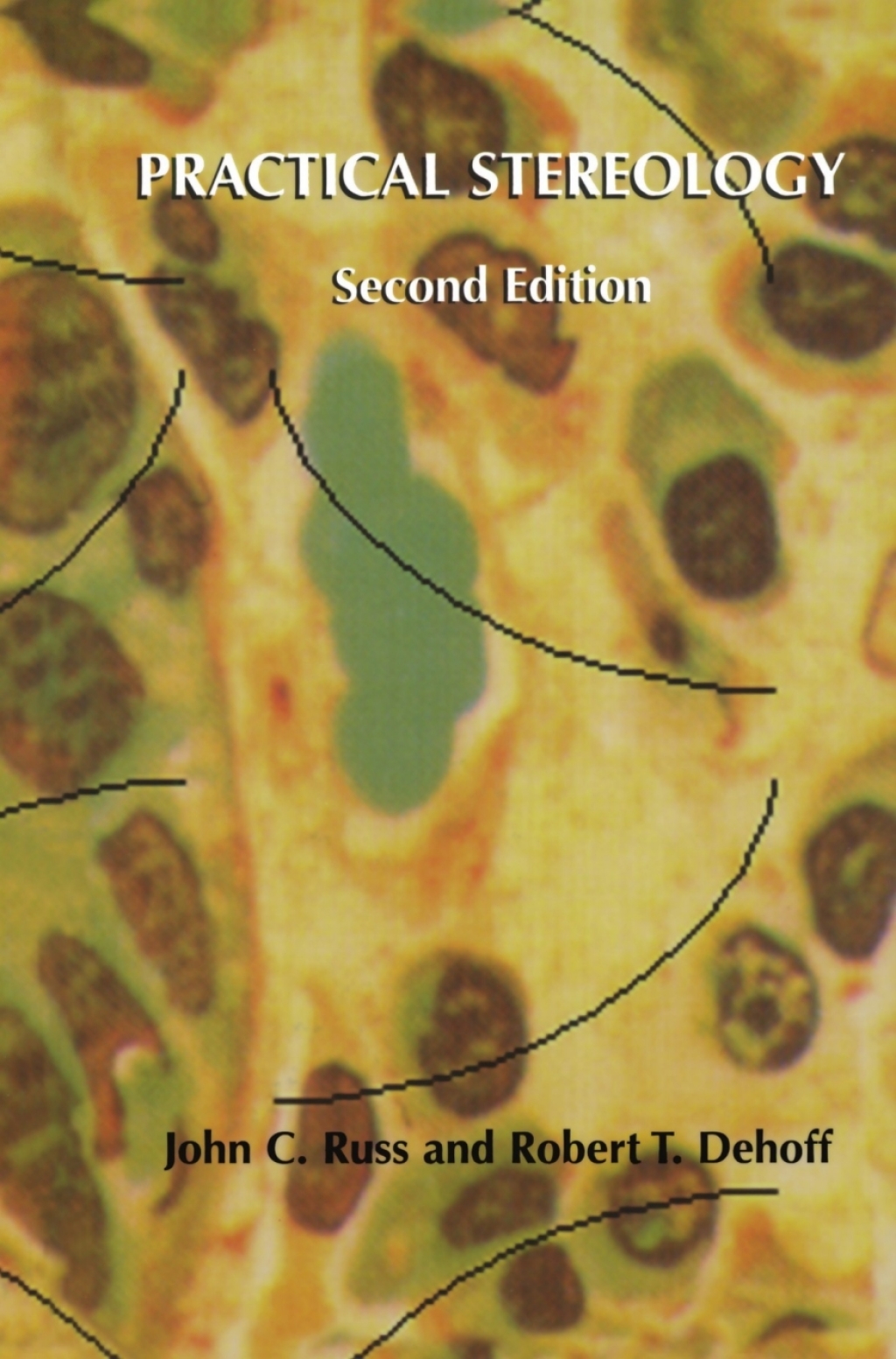 Practical Stereology 2nd Edition