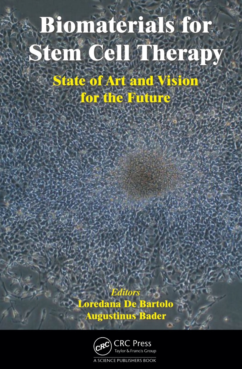 Biomaterials for Stem Cell Therapy State of Art and Vision for the Future 1st Edition