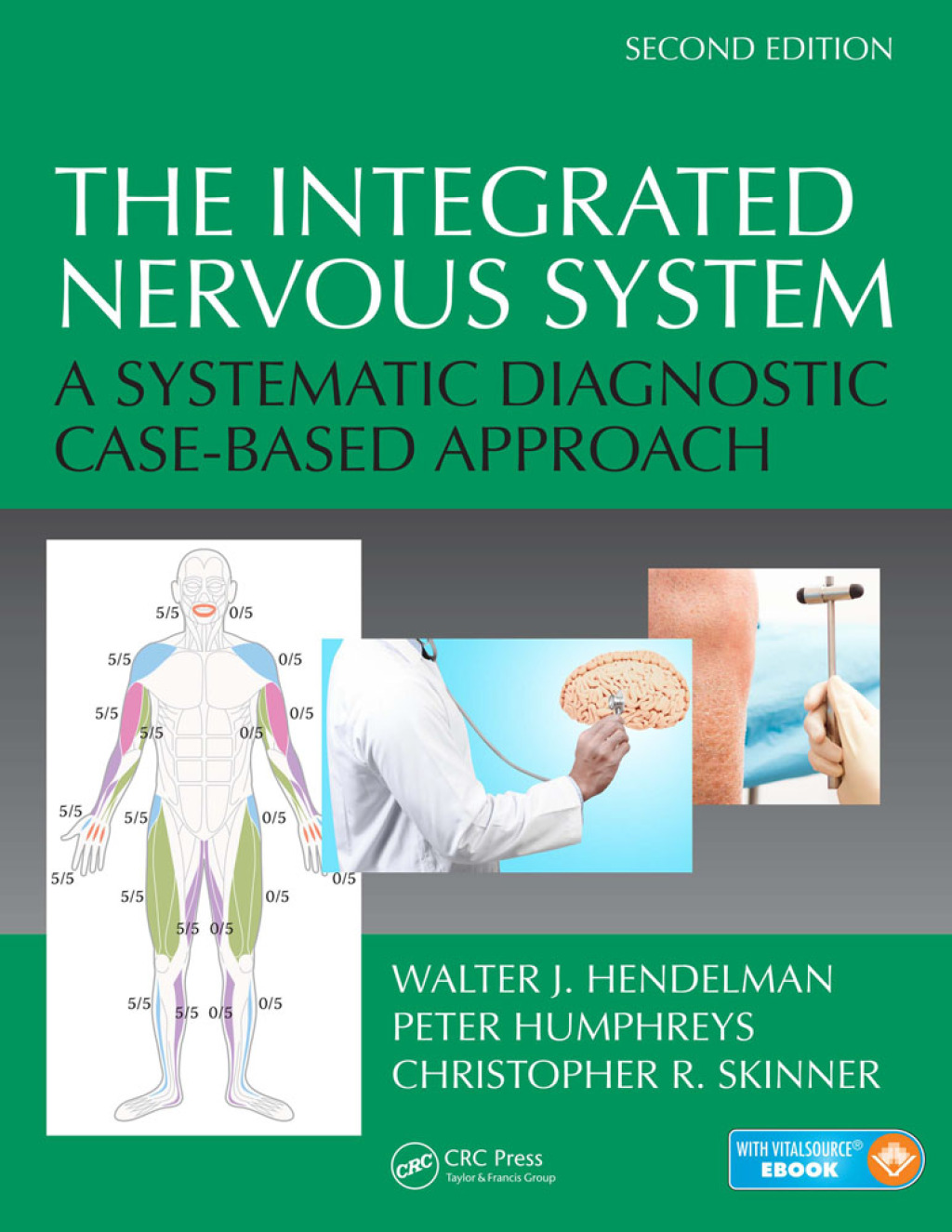 The Integrated Nervous System A Systematic Diagnostic Case-Based Approach, Second Edition 2nd Edition