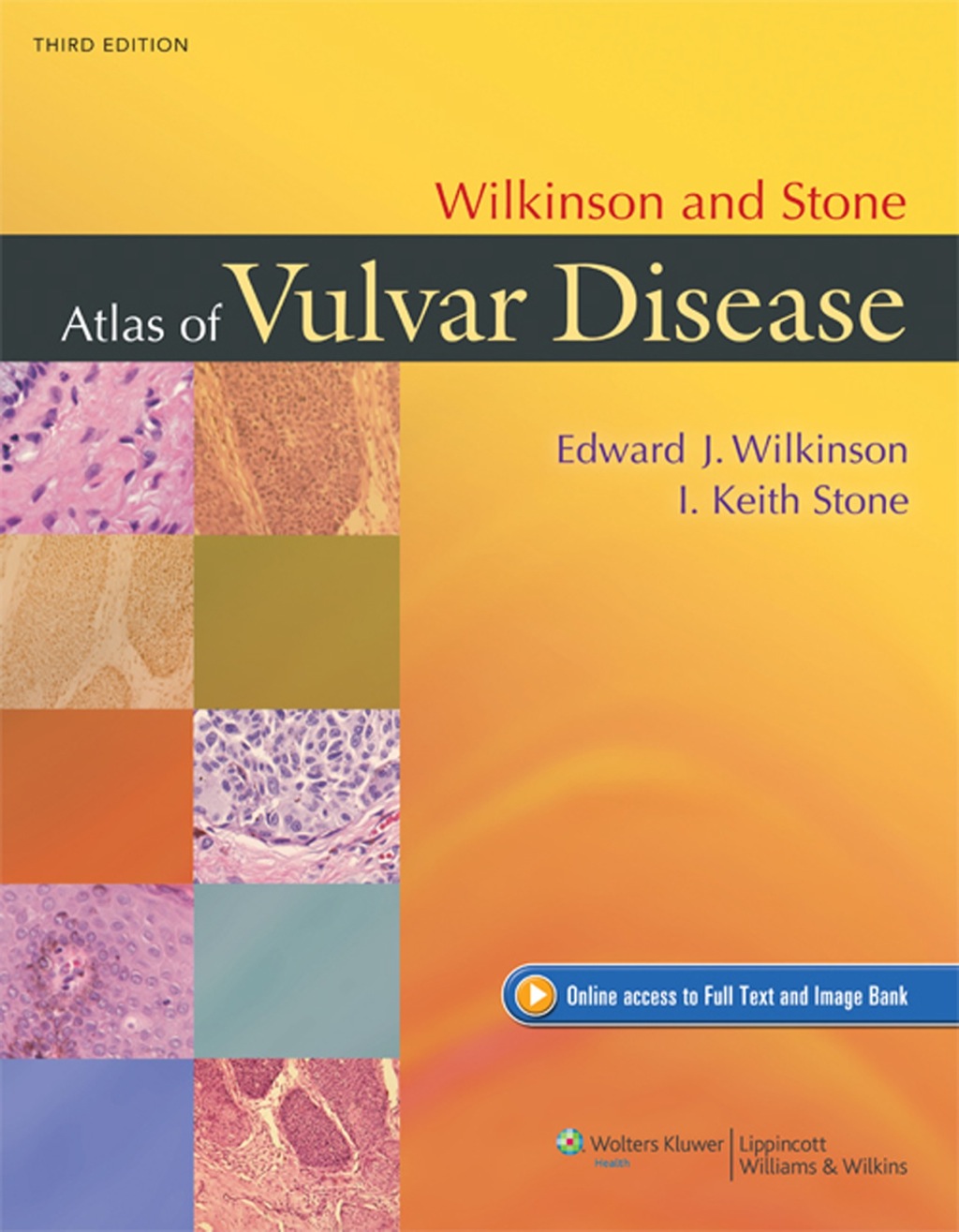 Wilkinson and Stone Atlas of Vulvar Disease 3rd Edition