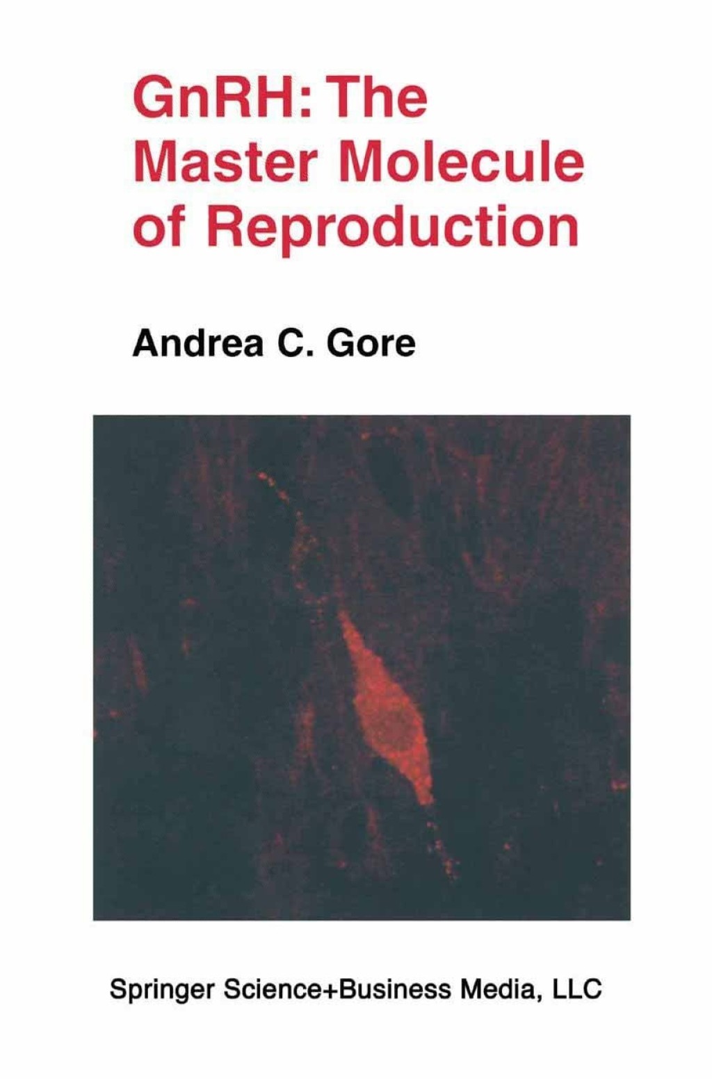 GnRH: The Master Molecule of Reproduction 