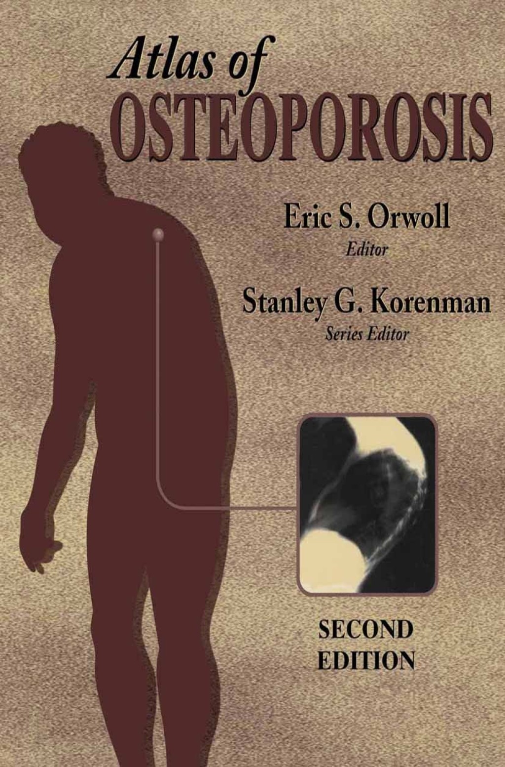 Atlas of Osteoporosis 2nd Edition