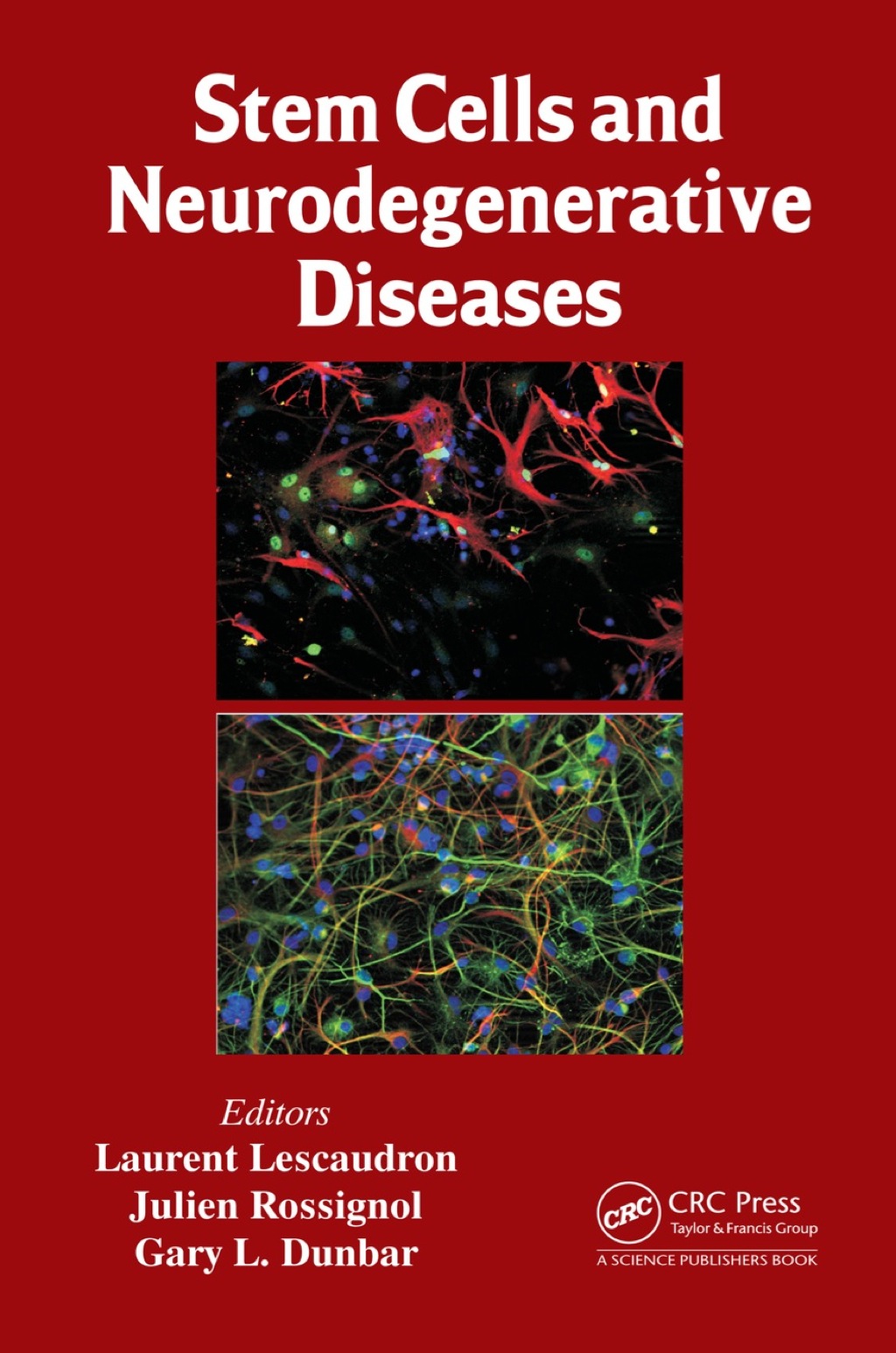 Stem Cells and Neurodegenerative Diseases 1st Edition