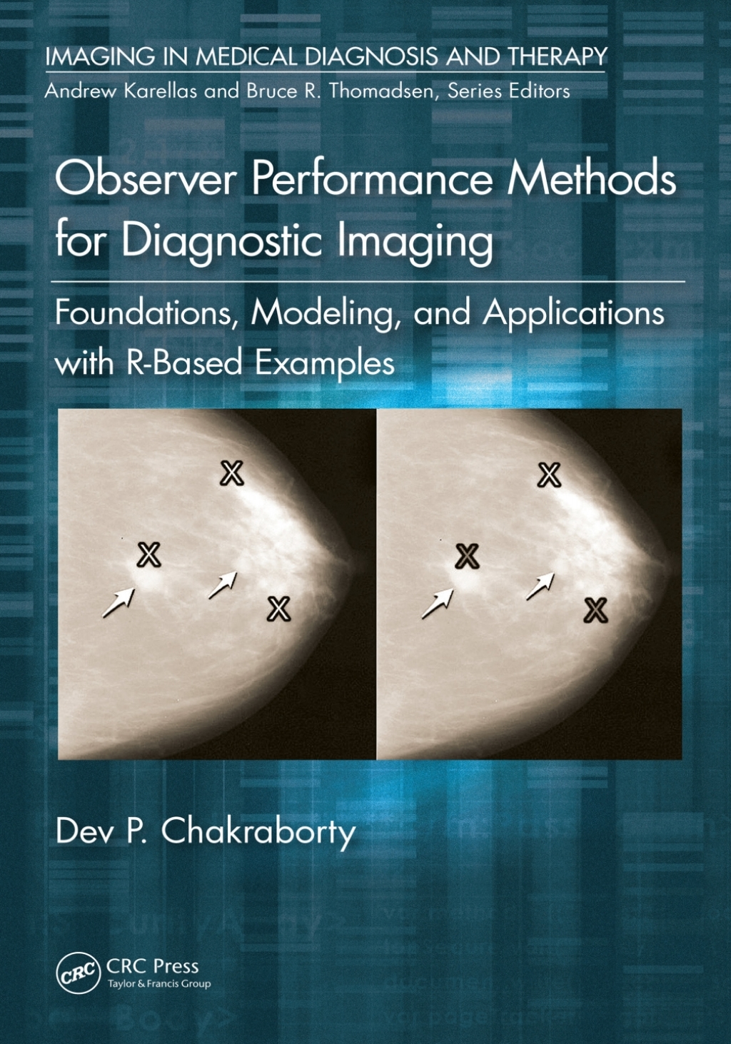 Observer Performance Methods for Diagnostic Imaging Foundations, Modeling, and Applications with R-Based Examples 1st Edition