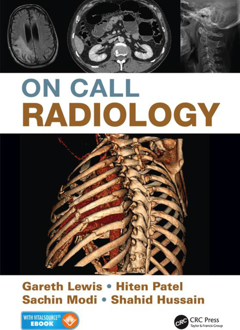 On Call Radiology 1st Edition