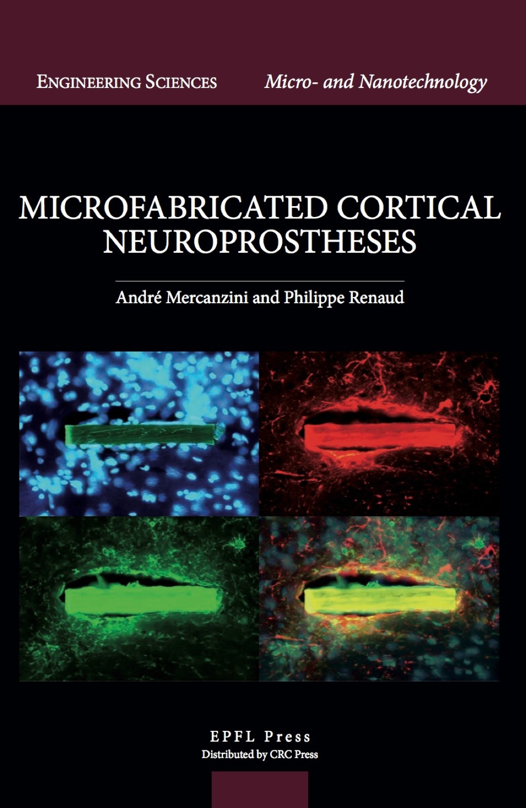 Microfabricated Cortical Neuroprostheses 1st Edition