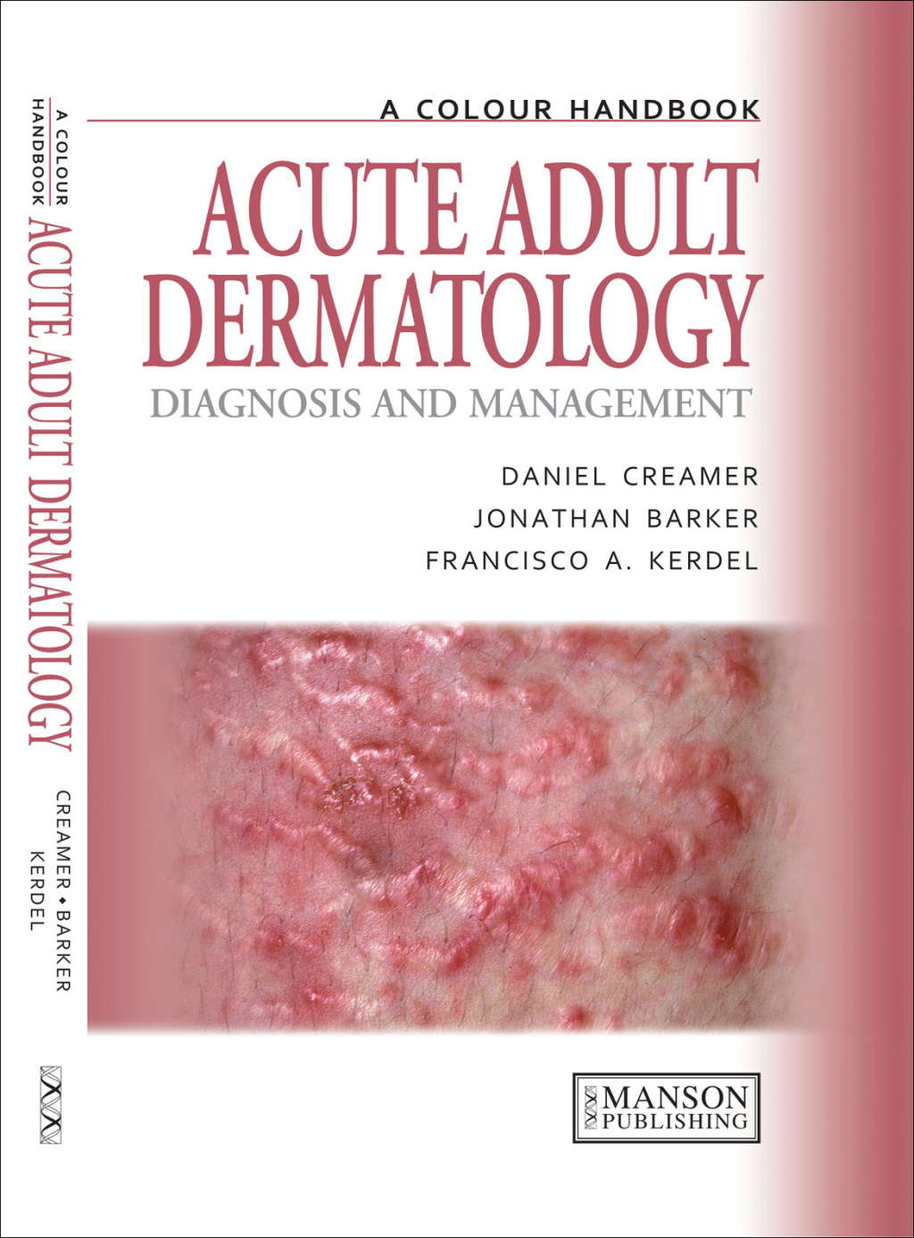 Acute Adult Dermatology Diagnosis and Management: A Colour Handbook 1st Edition
