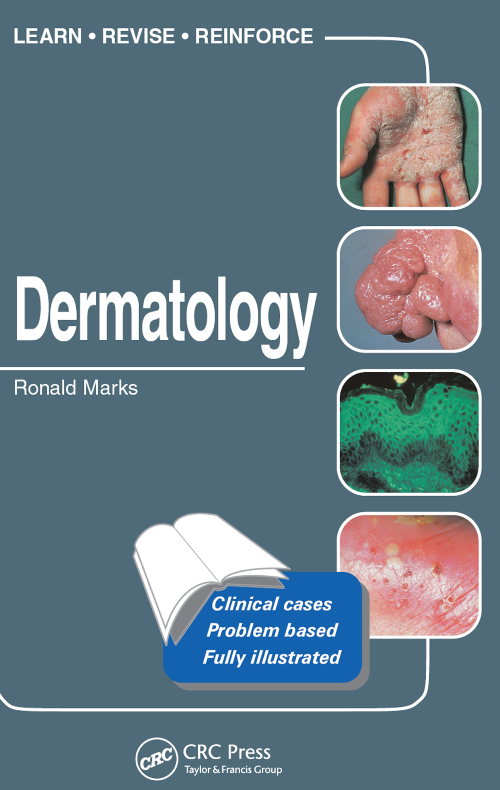 Dermatology Self-Assessment Colour Review 1st Edition