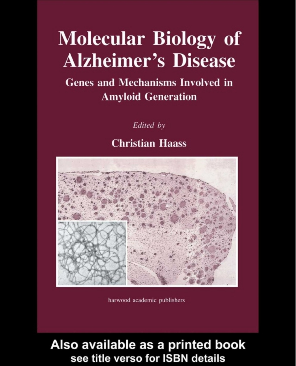 Molecular Biology of Alzheimer's Disease Genes and Mechanisms Involved in Amyloid Generation 1st Edition