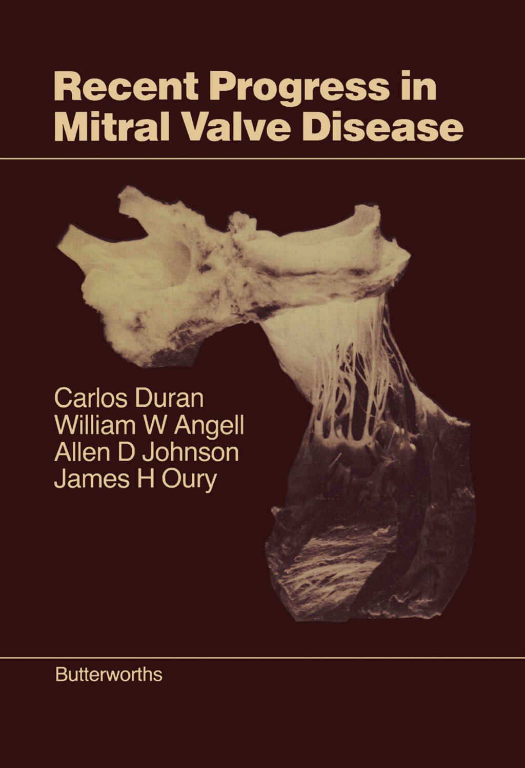 Recent Progress in Mitral Valve Disease 