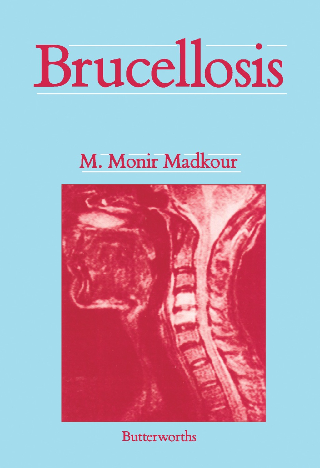 Brucellosis 